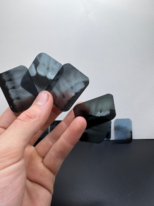 Antique Dental X-Ray Slides (Set of 10)