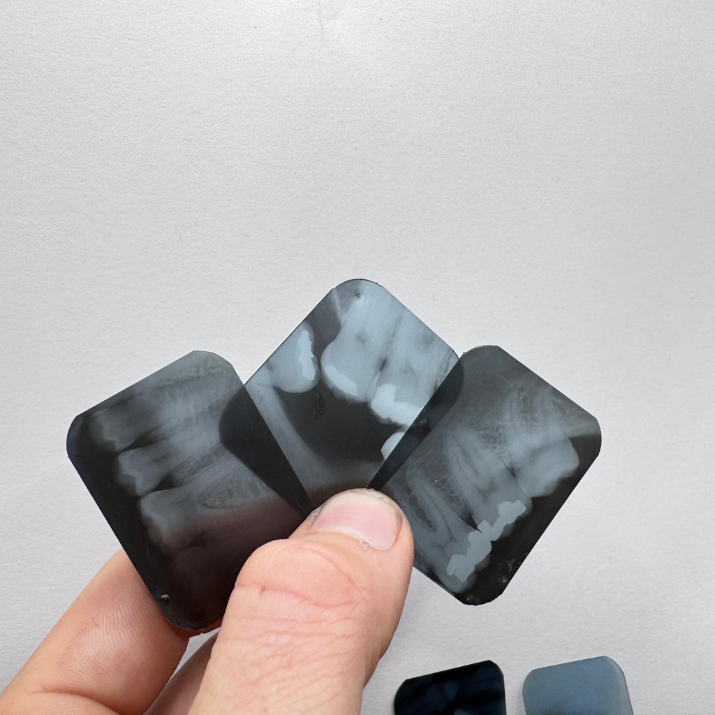 Antique Dental X-Ray Slides (Set of 10)