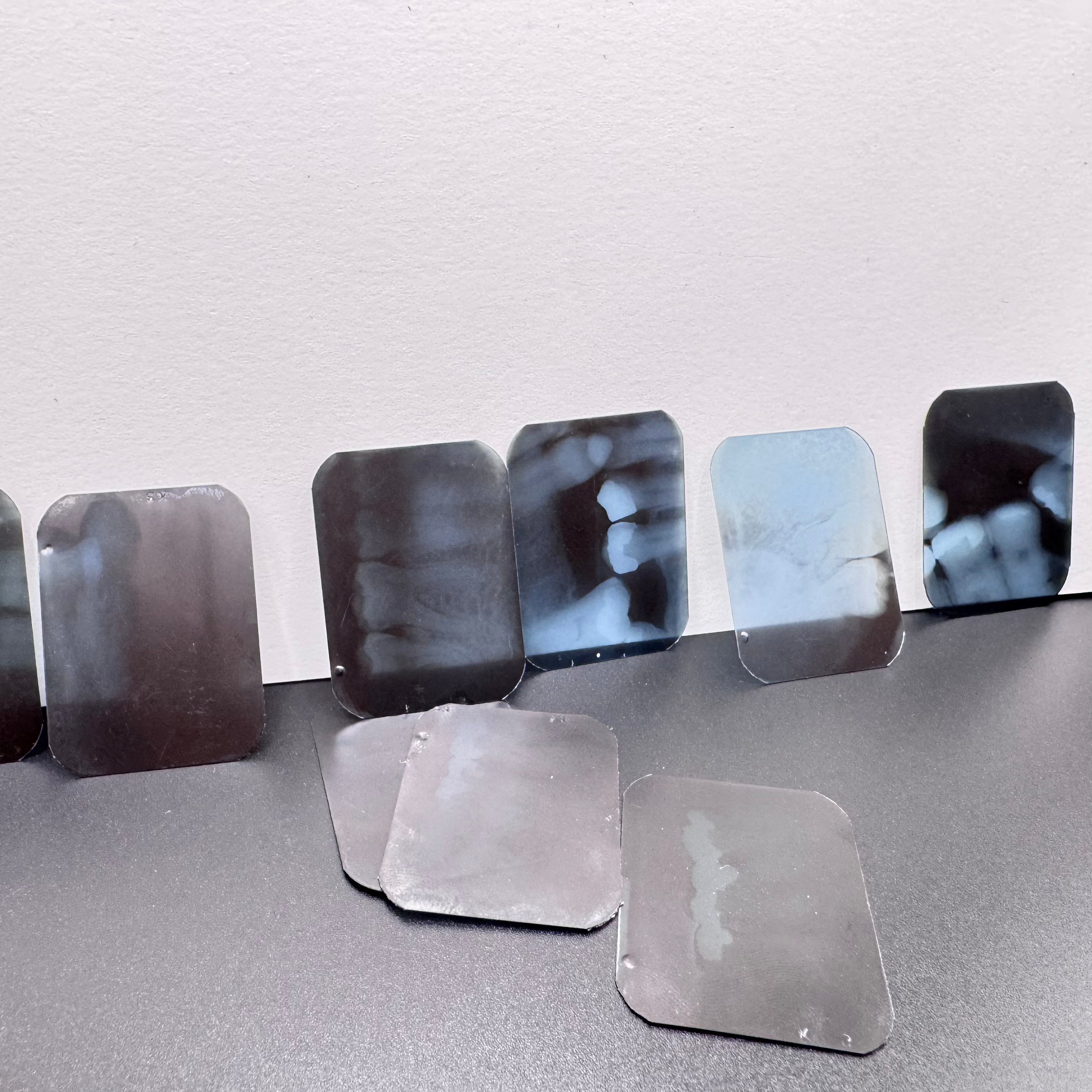 Antique Dental X-Ray Slides (Set of 10)